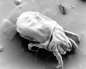 CSIRO_ScienceImage_11085_A_scanning_electron_micrograph_of_a_female_dust_mite